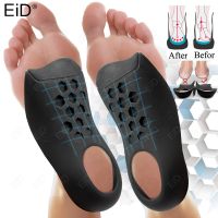 ☇ EiD Orthotic Insoles for XO-Legs Correction Orthopedic Flat Feet Heel Pain Arch Support For Man Woman Shoe Insoles Sole Insert