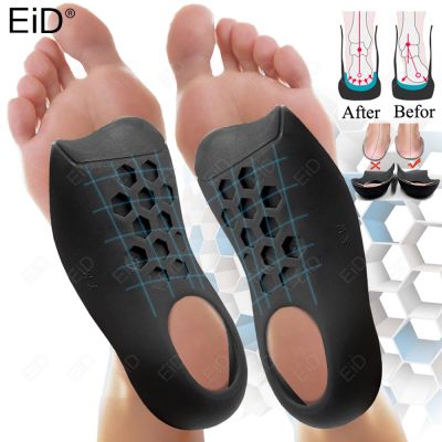 ☇ EiD Orthotic Insoles for XO-Legs Correction Orthopedic Flat Feet Heel Pain Arch Support For Man Woman Shoe Insoles Sole Insert