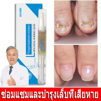 เซรั่มซ่อมแซมเล็บ Nail Repair Serum เซรั่มซ่อมแซมเล็บ ซ่อมแซมและบำรุงเล็บที่เสียหาย（น้ำยาฆ่าเชื้อราที่เล็บ ครีมบำรุงเล็บ น้ำมันบำรุงเล็บ ครีมเชื้อราที่เล็บ เซรั่มรักษาเล็บเชื้อรา ยาทาเชื้อราที่เล็บ น้ำยาใส่เล็บขบ ยาฆ่าเชื้อเล็บ ยาฆ่าเชื้อราเล็บ ）