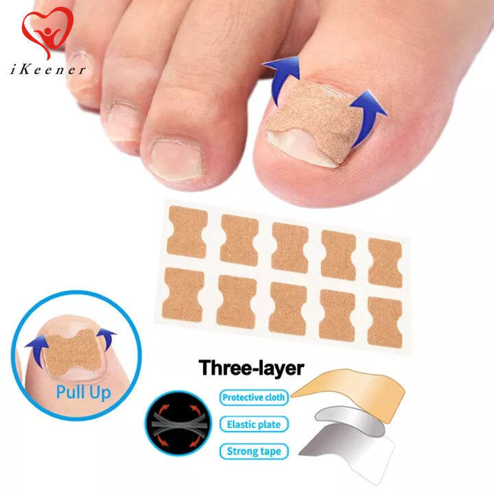 iKeener 10/20/50pcs Ingrown Toenail Corrector Stickers Foot Care ...