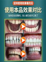 High efficiency Japan original [Full refund for non-fixed teeth] Severe tooth loosening bleeding shrinkage fixed teeth Genuine repair tooth root shaking toothpaste F