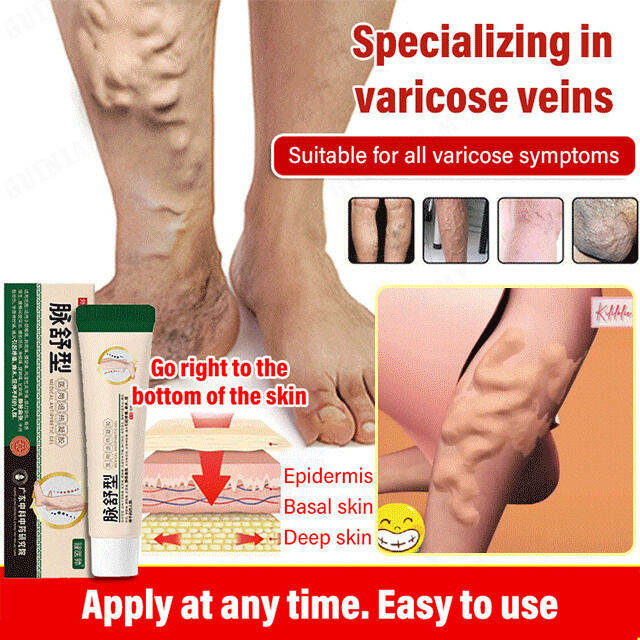 guinian. Scar Care guinian Varicose Vein Cold Compress Gel Lazada