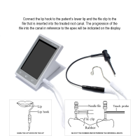 ทันตกรรมมินิ Apex Locator แบบพกพา Endodontics เครื่องมือวัดที่ถูกต้องสำหรับการรักษาผ่าตัดคลองราก