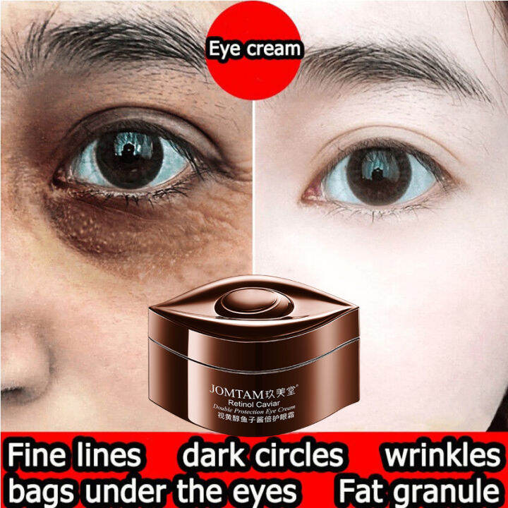 JOMTAM Retinol Caviar Eye Cream Remover Wrinkle Eye Bag Dark Circle ...