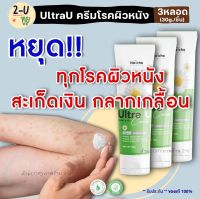 รีวิวเยอะ/ส่งฟรี!! [3หลอด] อัตรายูครีม Ultra U Cream **ของแท้ จัดส่งเร็ว** แก้เชื้อรา โรคผิวหนัง กลาก เกลื้อน สะเก็ดเงิน ร้านทูยู 2-U