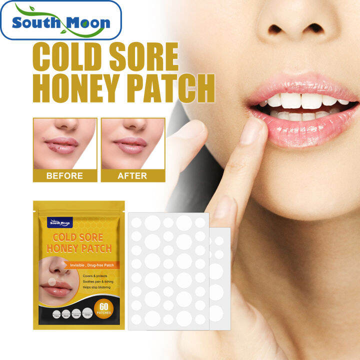 South Moon Cold Sore Honey Patch Cold Sore Lip Patch Mouth Canker Sores