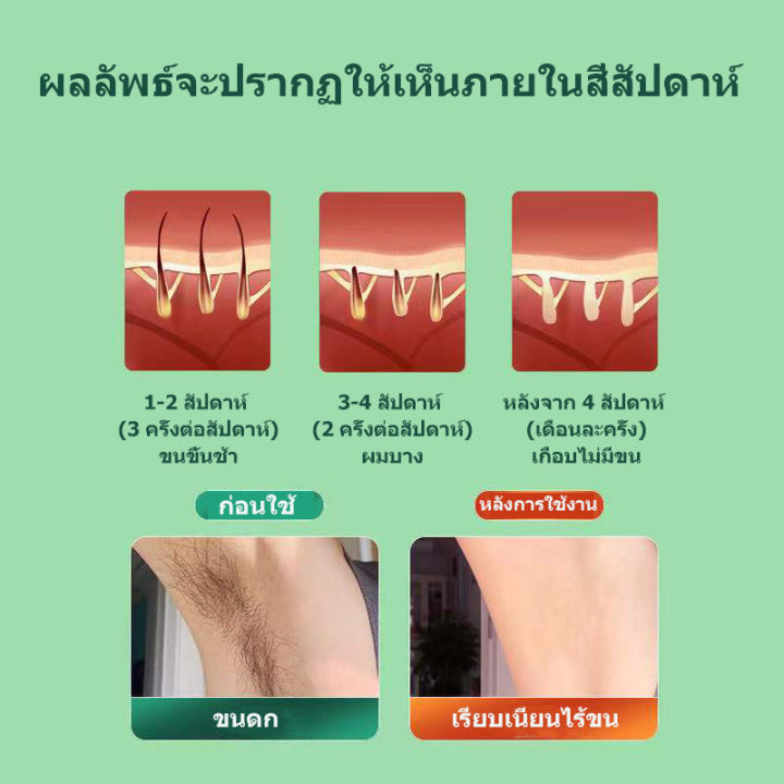 เครื่องกำจัดขนipl-เครื่องเลเซอร์-เครื่องถอนขนรักแร้-กำจัดขนถาวร-เครื่องกำจัดขน-เครื่องถอนขนไฟฟ้า-ถอนขนจักแร้-ที่โกนขนที่ลับ-ที่ถอนขนไฟฟ้า-เรเซอร์กำจัดขน-เครื่งกำจัดขน-โกนขนหมอยไฟฟ้า-มีดโกนรักแร้-ที่โก