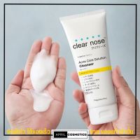 ClearNose โฟมล้างหน้า ลดสิว แถบสีเหลือง เคลียร์โนส แอคเน่ แคร์ โซลูชั่น คลีนเซอร์ [แบบหลอด 150 มล.] สุดคุ้ม