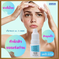 ตรงปกไม่จกตา?กิฟารีนโลชั่นแต้มสิวแอคทิฟยังขจัดสิ่งอุดตันรูขุมขน/จำนวน1ชิ้น(บรรจุ10มล.)รหัส22101?ของแท้เห็นผลไว