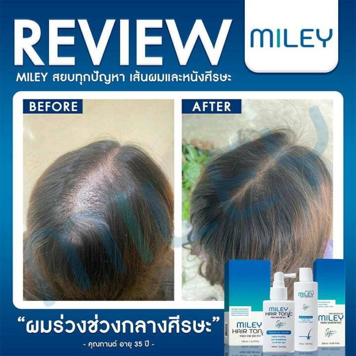 ฟรีจัดส่ง-2-แถม-1-skinagem-สกิน-เอเจ้มม์-ครีมหน้าเรียวและแอมพูลกู้หน้า-แถมฟรี-โฟม-ผลิตจากประเทศเกาหลีของแท้100