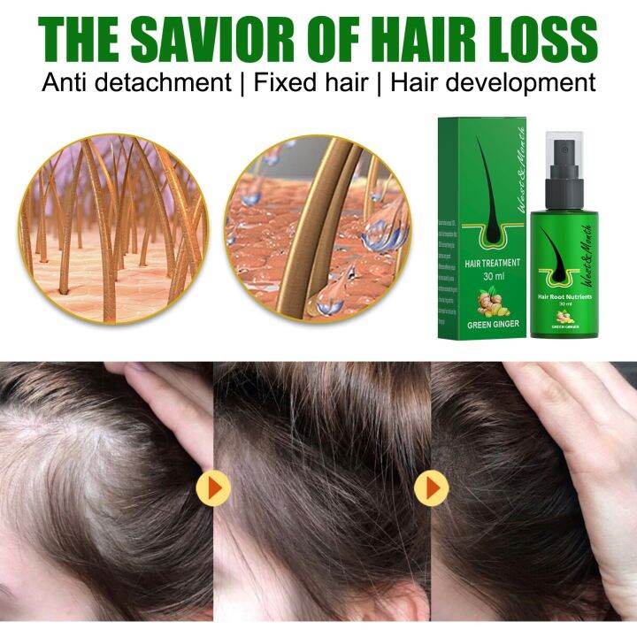 cw-ginger-hair-growth-products-fast-growing-hair-essential-oil-beauty-hair-care-prevent-hair-loss-oil-scalp-treatment-for-men-women