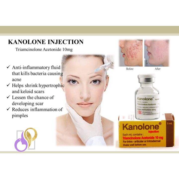 INSTANT PIMPLE ACNE REMOVAL beauty set Kanolone (with free SET) exp