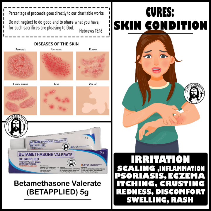 baby and adult cream BETAPPLIED 5g betametasone for itch, rashes