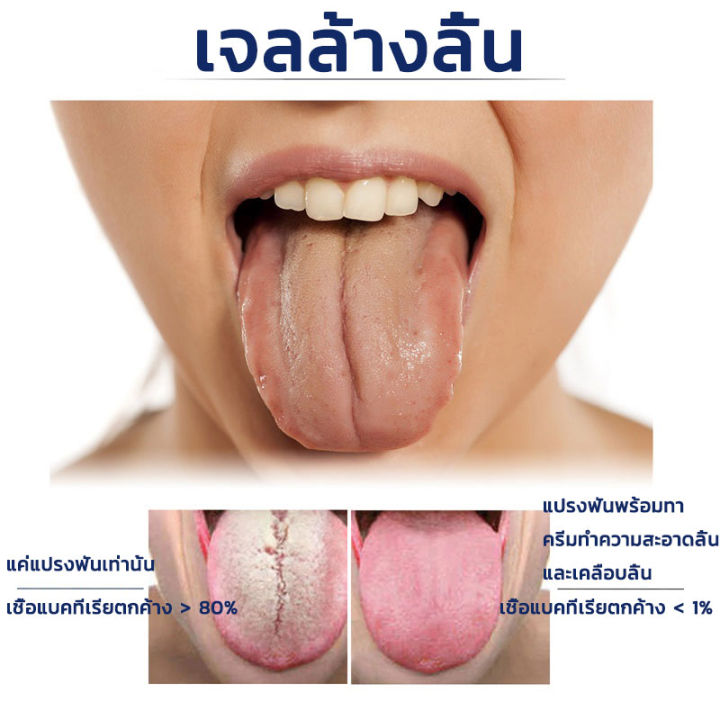 eelhoe-เจลทําความสะอาดลิ้น-แปรงลิ้น-ที่ทำความสะอาดลิ้น-50g-กำจัดกลิ่นปาก-ทำความสะอาดลิ้นเคลือบ-ลดกลิ่นปาก-ผลิตภัณฑ์ดูแลช่องปาก-อุปกรณ์ทำความสะอาดลิ้น-ที่ขูดลิ้น-แปรงลิ้น-แปรงขูดลิ้น-ที่แปรงลิ้น-แปรงทำ