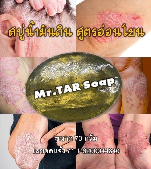 สบู่น้ำมันดินmr-tar-soap-สบู่น้ำมันดิน-100กรัม-สะเก็ดเงิน-เซบเดิร์ม-ผิวหนังอักเสบ-ผื่นคัน-ส่งด่วน