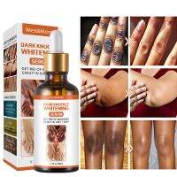 【CW】 50g Body Whitening Serum Oil Joint De blackening Lighten Melanin Knee Ankle Corner Brighten Corrector Skin Rejuvenation Bleach