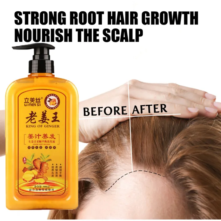 100% Original Ginger Hair Shampoo Anti Hair Loss Nourish Hair Fast Growth  Shampoo Oil Control Anti-Dandruff Repair Shampoo Scalp Treatment 500ml |  Lazada PH