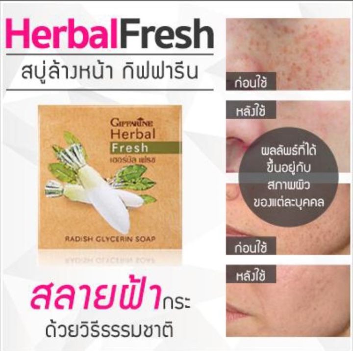 พร้อมส่ง-สบู่หัวไชเท้า-กิฟฟารีน-เฮอร์บัล-เฟรช-สบู่กลีเซอรีน-ผสมหัวไชเท้า-ฝ้า-กระ-จุดด่างดำ