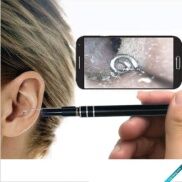 Camera nội soi tai, lấy ráy tai camera, lấy ráy tai có camera