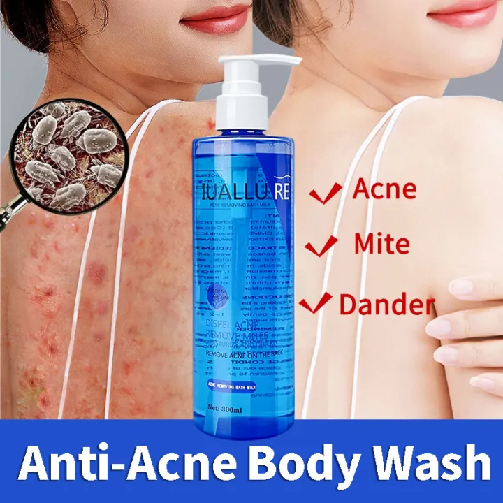 AntiAcne Body Wash AntiMite & AntiItch For Men & Women AntiAcne