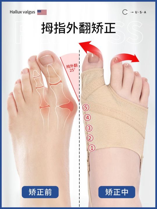 american-brand-hallux-valgus-toe-corrector-toe-separation-correction-toe-splitter-thumb-belt-big-foot-bone-female