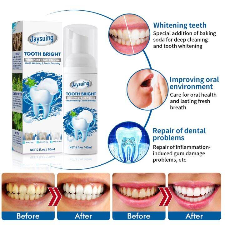 new Mousse Toothpaste Whitening Toothpaste Oral Care Whitens Teeth ...