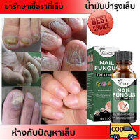 เชื้อราเล็บ30ml EELHOE ปรับปรุงเล็บให้แข็งแรงและมีสุขภาพดีใน2-4สัปดาห์ เล็บเชื้อรา น้ำมันบำรุงเล็บ ยารักษาเชื้อราที่เล็บ น้ำยาซ่อมแซมเล็บ ครีมบำรุงเล็บ ยาฆ่าเชื้อราเล็บ เซรั่มทาเล็บ ฆ่าเชื้อราที่เล็บ ลากับเล็บเสีย