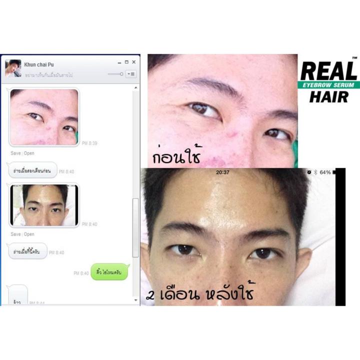 real-hair-eyebrow-serum-ขนาด12ml-เรียลแฮร์-อายโบร์ว-เซรั่ม-ปลูกขนคิ้ว-ขนตา-หนวด-เครา-จอนในขวดเดียว-3-กล่อง