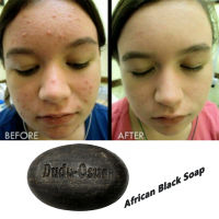 African Black Soap Dudu Osun pure natural Shea Butter Handmade Black Soap clears acne, stretch marks, dark spots blemishes 150g