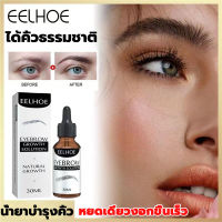 EELHOE เซรั่มทาคิ้วดก30ml สร้างคิ้วที่ดูเป็นธรรมชาติ น้ำยาปลูกคิ้ว เซรั่มปลูกคิ้ว เซรั่มคิ้วดกดำ เซรั่มปลูกหนวด น้ำยาปลูกผม น้ำยาปลูกหนวด นำ้ยาปลุกคิ้ว ครีมปลูกคิ้ว น้ำยาปลูกคิ้ว น้ำยาปลูกขนคิ้ว ปลูกคิ้วดกดำ ที่ปลูกคิ้ว น้ำยาเร่งคิ้ว ยาปลูกคิ้วดก ยาคิ้วดก