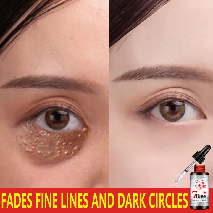 eye cream eyebag remover dark eye circle remover eyebag and dark circle