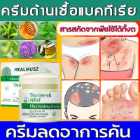 【สินค้าใหม่แนะนำ?】ครีมแก้คัน แก้กลาก สะเก็ดเงิน สูตรพืช แพ้ยุง ซ่อมแซมความเสียหาย เพิ่มน้ำมันทีทรีโพลิส itching cream