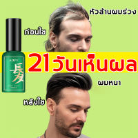 สูตรปลูกผมจากรากหนังศีรษะ ปลูกผมง่ายๆ น้ำยาปลูกผม 30ml  ช่วยลดผมร่วง ป้องกันผมร่วง เซรั่มปลูกผม ยาปลูกผมของแท้ สเปย์ปลูกผม hair grow