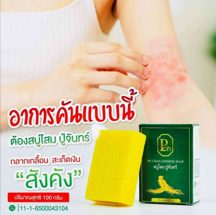 สบู่โสมปู่จันทร์-แก้กลากกลื้น-เชื้อรา-ringworm-soap100-กรัม