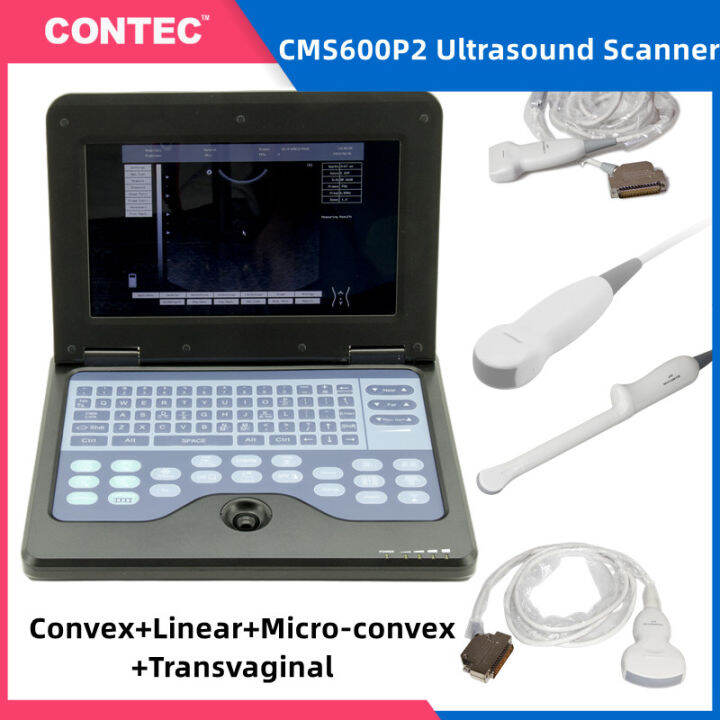 CONTEC CMS600P2 B-Ultrasound Diagnostic System Portable Laptop Digital ...