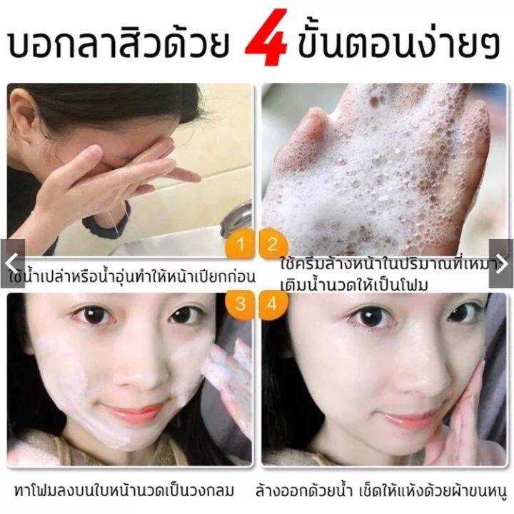 โฟมล้างสะอาดสิว-โฟมล้างหน้าขาว-โฟมล้างหน้าสะอาด-ครีมล้างหน้าให้ออก-ที่ล้างหน้าสิว-โฟมล้างหน้า-โฟมล้างหน้าขวดใหญ่-โฟมล้างหน้าของเซซัคมอร์