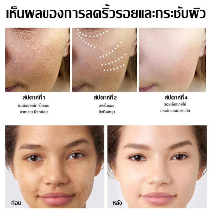 retinol-essence-เซรั่มต่อต้านริ้วรอย-ครีมลดริ้วรอย-เซรั่มหน้าใส-เซรั่มทาใบหน้า-บำรุงผิวหน้า-ลดริ้วรอย-ตีนกา-กระชับผิว-ปรับปรุงผิวหมองคล้ำ