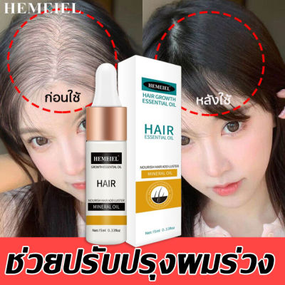 HEMEIEL  น้ำยาปลูกผม/ที่เร่งผมยาว/บำรุงผมยาวเร็ว/ไม่ต้องกังวลกับปัญหาผม /hair serum