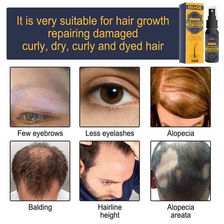 eelhoe-50ml-castor-oil-hair-growth-spray-anti-hair-loss-essential-oil-products-fast-treatment-ป้องกันผมบางแห้ง-frizzy
