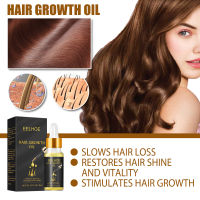 Eelhoe Hair Grow Essence Oil สารสกัดจากพืชธรรมชาติ ต่อต้านผมร่วงและการเจริญเติบโตอย่างรวดเร็ว บำรุงและซ่อมแซมเส้นผมที่เสียหายอย่างล้ำลึก