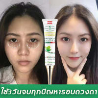 Aichun ครีมกำจัดถุงใต้ตา ครีมบำรุงใต้ตา เซรั่มทาถุงใต้ตา 30ml กระชับรอยตีนกา บรรเทาปัญหาต่างๆรอบดวงตา คนีมบำรุงรอบดวงตา ครีมทาตาเม็ดไขมัน ​ครีมบำรุงรอบตา ​เซรั่มถุงใต้ตา ​ครีมทาใต้ตาดำ บำรุงสายตา ครีมทาตาดำ