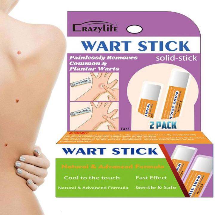 Wart Removal Stick Plantar Warts Removal Cream Painless Common Wart