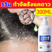 SHENGBAIMEI แชมพูขจัดรังแค 300ML ขจัดรังแค หยุดอาการคัน ควบคุมน้ำมัน แชมพูสมุนไพร บำรุงเส้นผมและหนังศรีษะ(ยาสระผมเชื้อรา ยาสระผมรังแค ยาสระผมขจัดรังแค ยาสระผมแก้เชื้อรา ยาสระผม แชมพูแก้เชื้อรา เชื้อราบนศีรษะ แชมพูแก้รังแค)