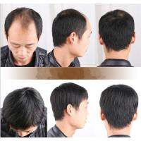 Middle-aged Man Wig Dad wig natural short hair (Black) 100 real hair man wig handmade Bald patch