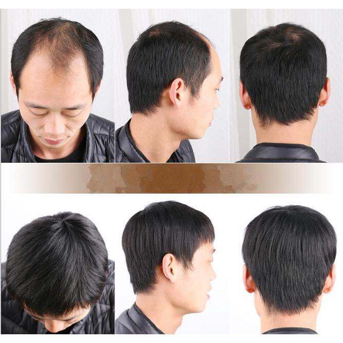 middle-aged-man-wig-dad-wig-natural-short-hair-black-100-real-hair-man-wig-handmade-bald-patch