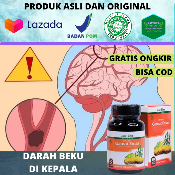 Obat Darah Beku Di Kepala Mengencerkan Darah Beku Akibat Jatuh Terbentur Gumpalan Darah 1417