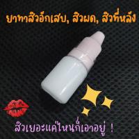 ยาทาสิว สิวผด สิวอักเสบ สิวที่หลัง เดอร์มาคลีนิค (ใช้เช้า-เย็น)