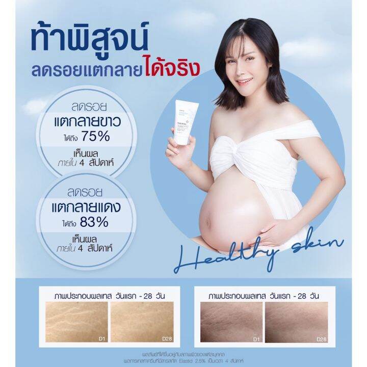 eves-เซตคู่ลดรอยแตกลาย-ครีมบูสเตอร์-ออยล์เจลอีฟส์-ป้องกันรอยแตกลาย-ลดรอยแผลเป็นจุดด่างดำ-ผิวกระจ่างใส-ชุ่มชื้นเนียนนุ่ม