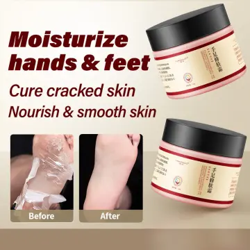 BEST Foot cream for Cracked Heels and Dry Skin | Derma Essentia |  QualityMantra - YouTube
