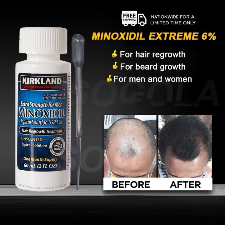 Original Kirkland Minoxidil with LCLT and Dropper 1 Month Supply Hair ...